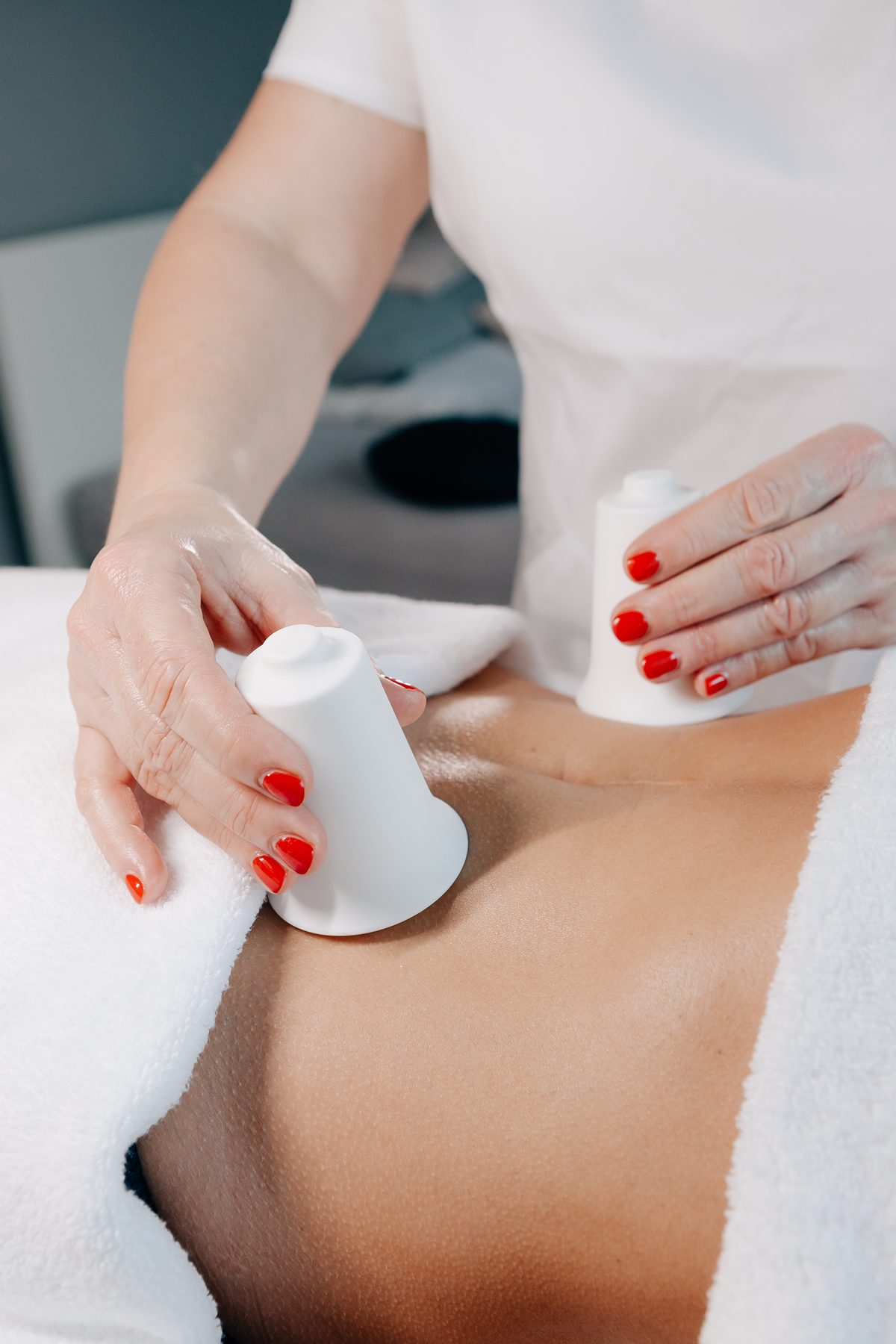 BellaBambi Face Lift – Natürliches Lifting